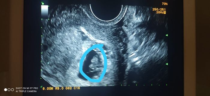 👶🏻futuras mamis febrero 2022👶🏻 3