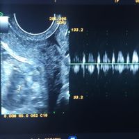 👶🏻futuras mamis febrero 2022👶🏻 - 1