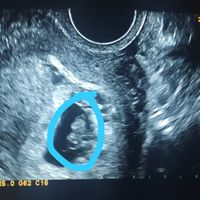 👶🏻futuras mamis febrero 2022👶🏻 - 2