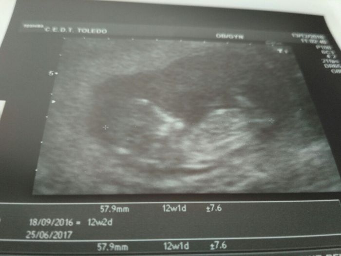Mamis julio 2017 - 1