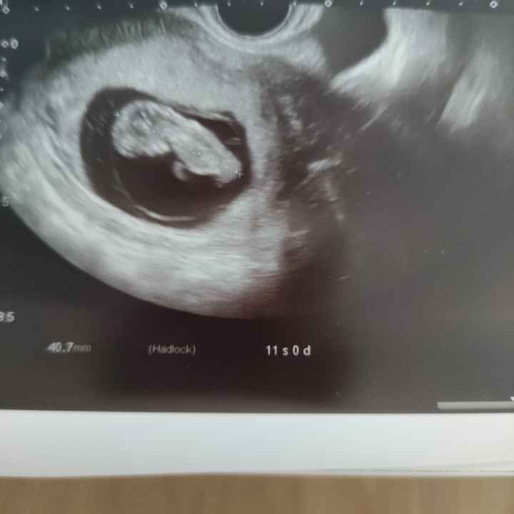 Futuras Mamis Noviembre - 2