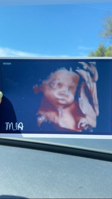 Futuras mamis noviembre 2022 1