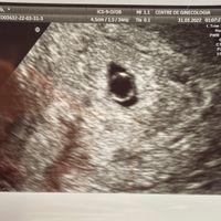 Futuras mamis noviembre 2022 - 1