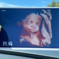 Futuras mamis noviembre 2022 - 1