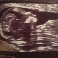 Mamis agosto 2017 - 1