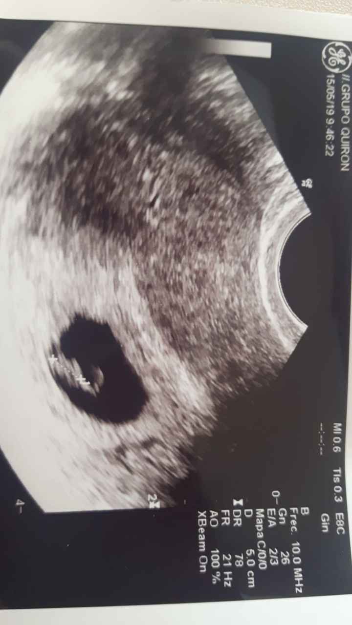 Superbaby