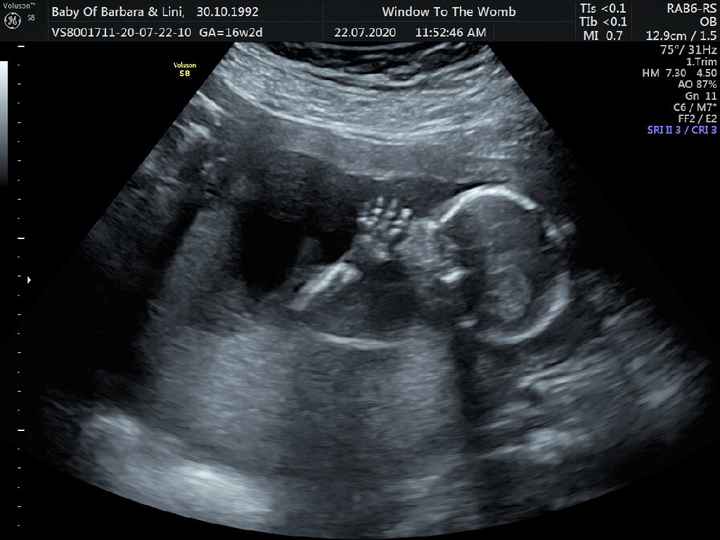 Futuras Mamis Enero 2021 - 2