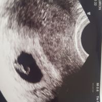 Superbaby