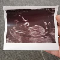 Futuras Mamis Enero 2021 - 1
