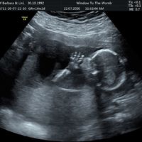 Futuras Mamis Enero 2021 - 2