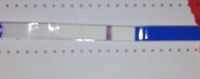 Embarazo y endometriosis - 1