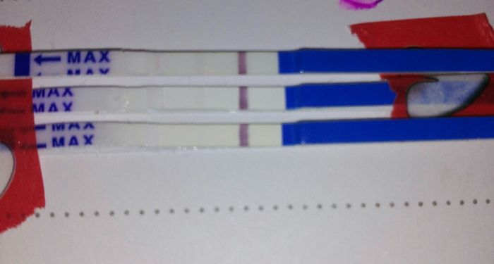 Embarazo y endometriosis - 1