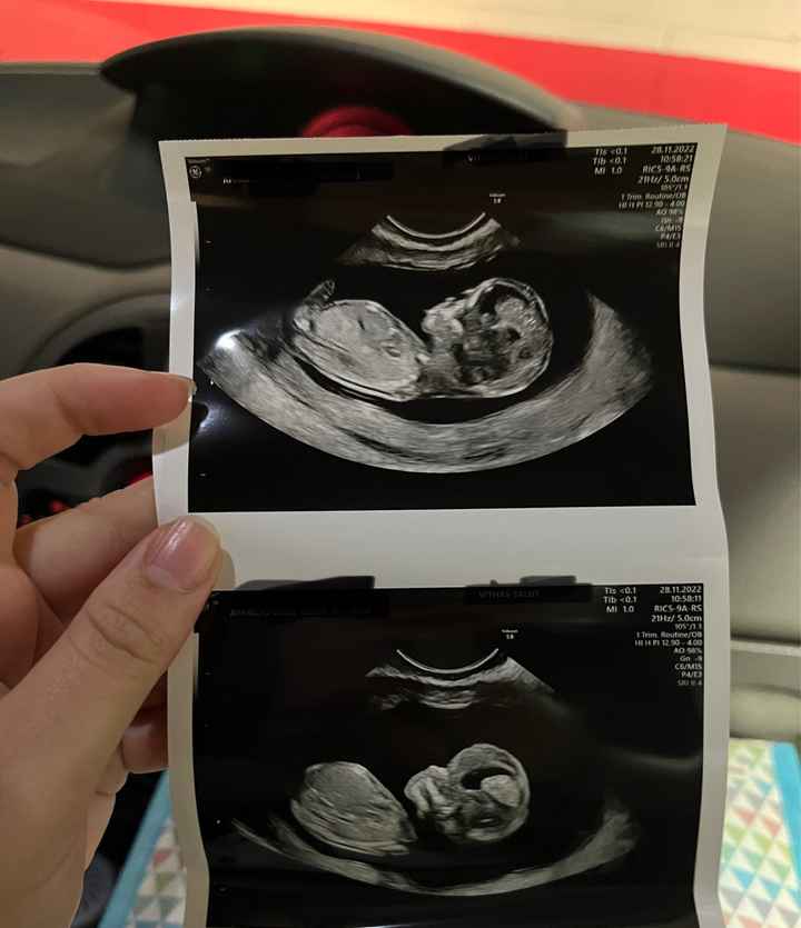 Futuras mamis Junio 2023 - 1