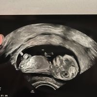 Futuras mamis Junio 2023 - 2