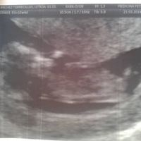 Mi bebe