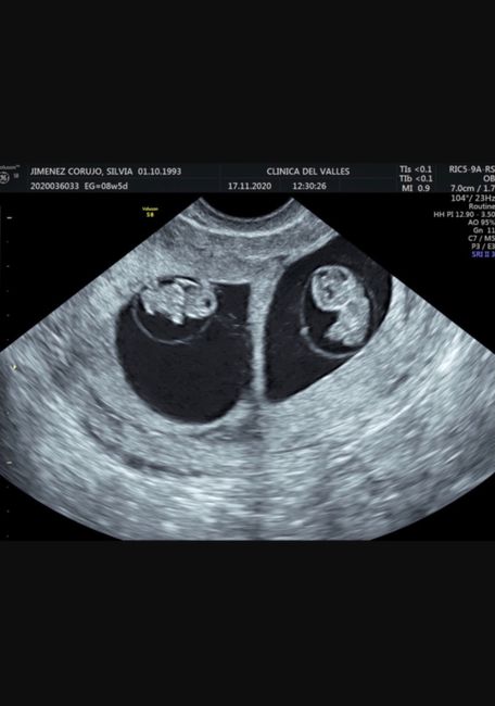 Futuras mamis junio 2021 🤰🏻❤️ oficial - 1