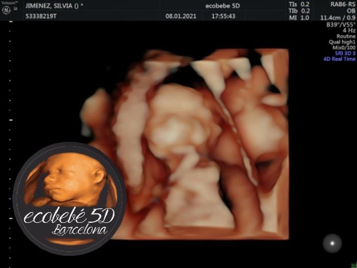 Futuras mamis junio 2021 🤰🏻❤️ oficial - 2