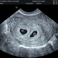 Futuras mamis junio 2021 🤰🏻❤️ oficial - 1
