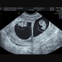 Futuras mamis junio 2021 🤰🏻❤️ oficial - 1