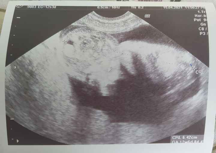 Futuras mamás octubre 2021 - 1