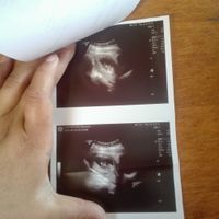 Ahora a las 9+4 semanas que tal? Ojalá sea niñaaa!! Muchas gracias :)