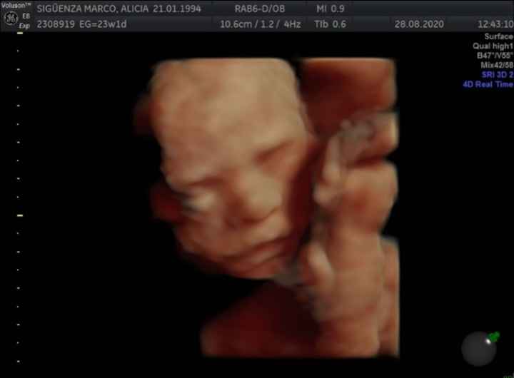 Futuras mamas Diciembre 2020 - 1