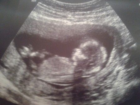 Nuestro bebe