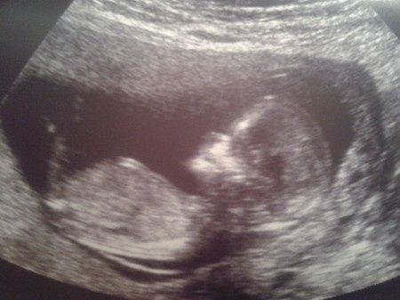 Nuestro bb