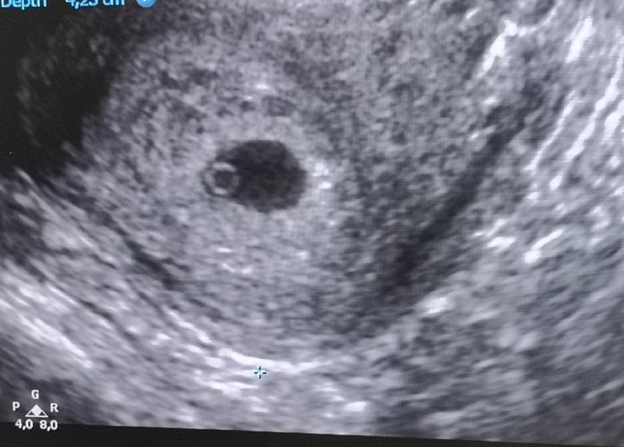 Futuras mamas octubre 2020 - 1