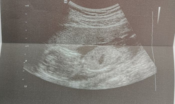 Futuras mamas octubre 2020 - 1