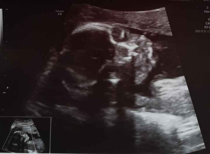 Futuras mamas octubre 2020 - 1