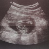 Futuras mamas octubre 2020 - 1