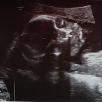 Futuras mamas octubre 2020 - 1