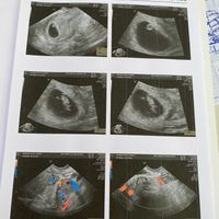 Futuras mamis Enero 2022 - 1