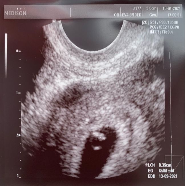 Futuras mamas septiembre 2021🤰🤱 1