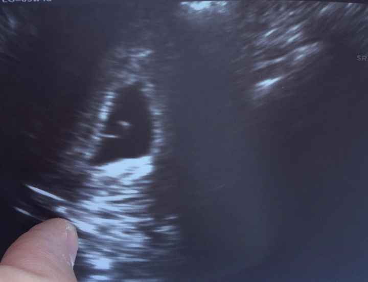 Futuras mamás Agosto 2020 1