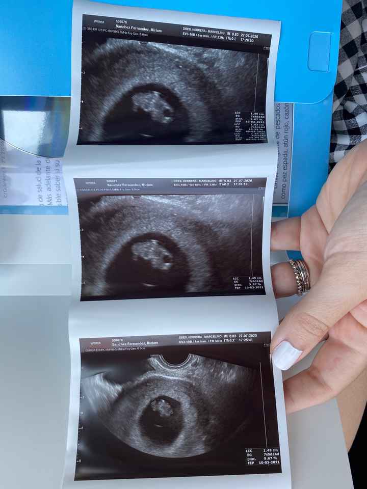 Futuras mamis Marzo 2021 ❤️❤️ - 1