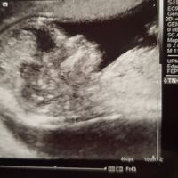 Futuras mamás Junio 2020 - 2