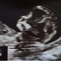 Futuras mamás Abril 2023 (actualizado) - 1