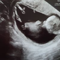 Futuras mamás Abril 2023 (actualizado) - 2