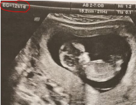 Futuras mamis junio 2018 1