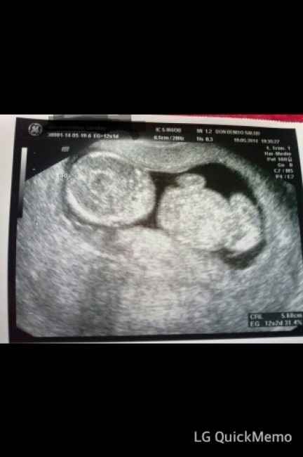 El consultorio de Lita para futuras mamis - 1