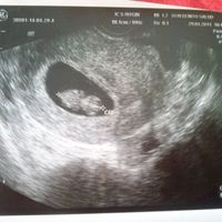 9 semanas y 1 día