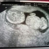 12 semanas