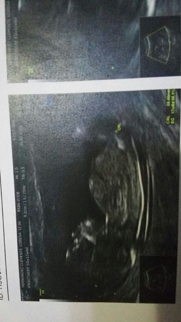Futuras mamas septiembre 2016 - 1