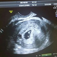 Futuras mamas septiembre 2016 - 1