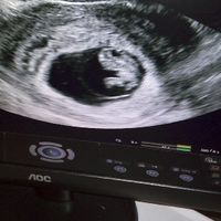 Futuras mamas septiembre 2016 - 1