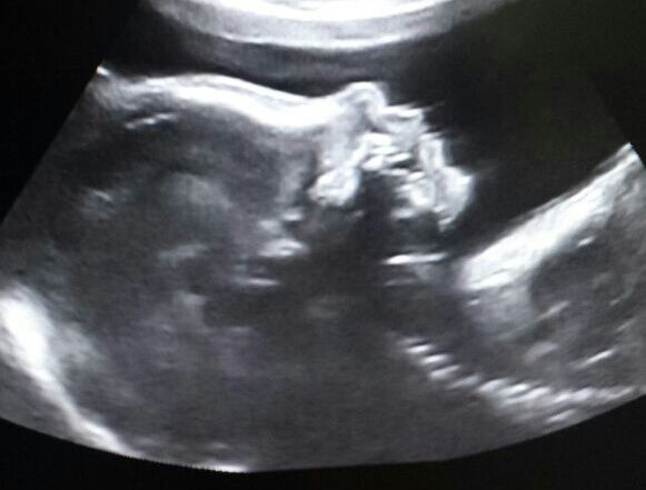 Mamas Abril 2015 - 1