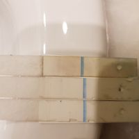 Embarazo y endometriosis - 1