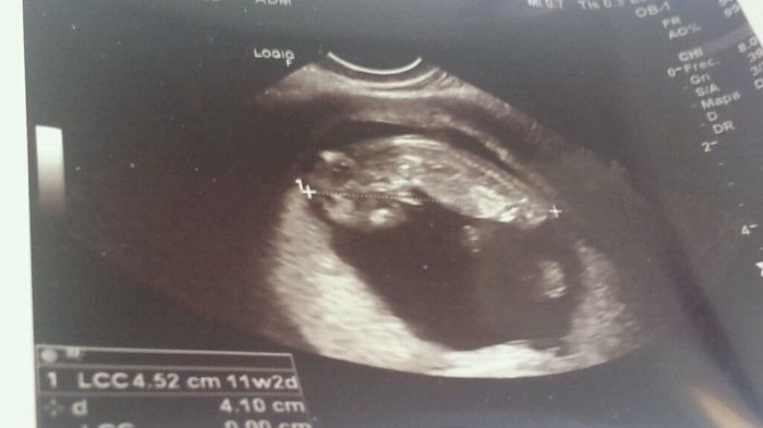 Mamis enero 2016 - 1